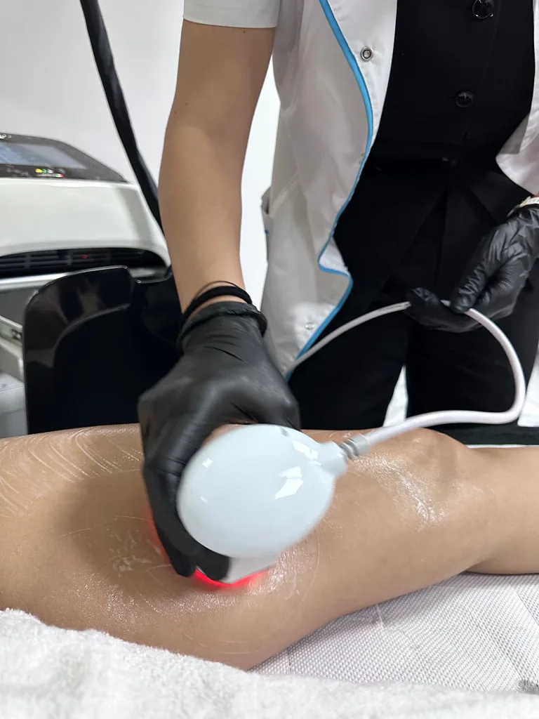 Tratament de remodelare pe coapse cu aplicatorul Endo Sinergy